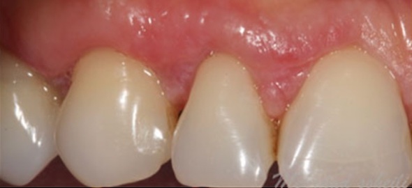 smile gallery image
