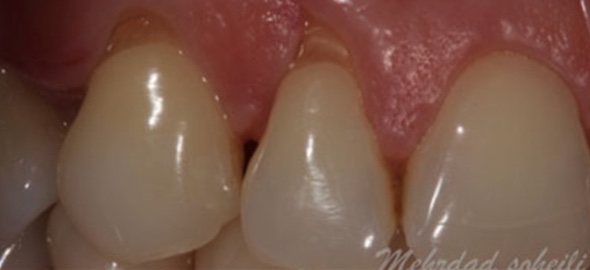 smile gallery image