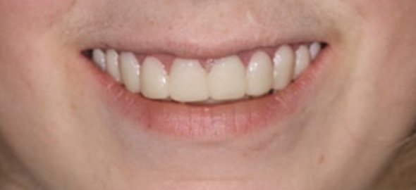smile gallery image