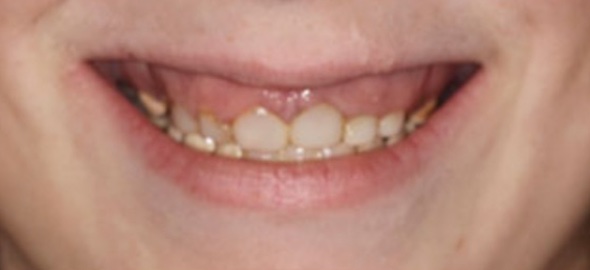smile gallery image