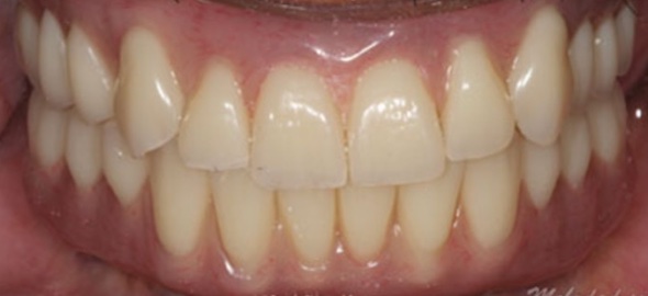 smile gallery image