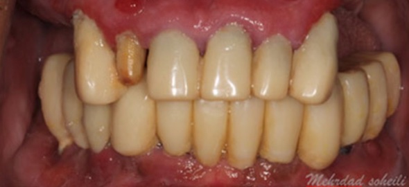 smile gallery image