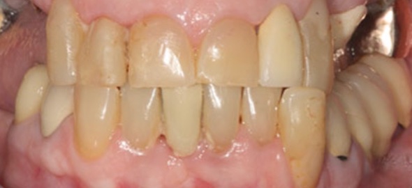 smile gallery image