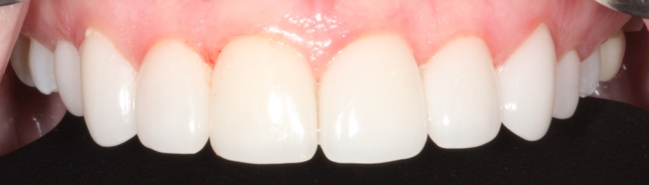 smile gallery image