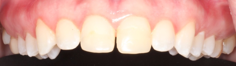 smile gallery image