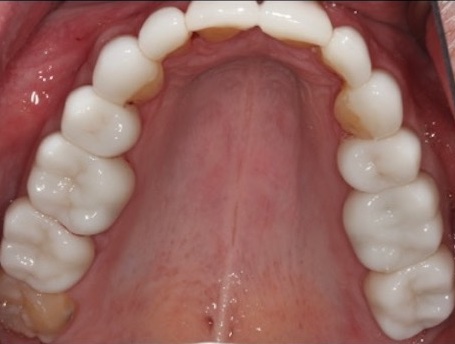 smile gallery image