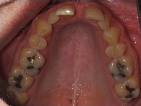 smile gallery image