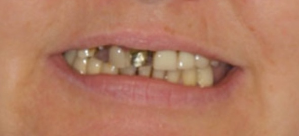 smile gallery image