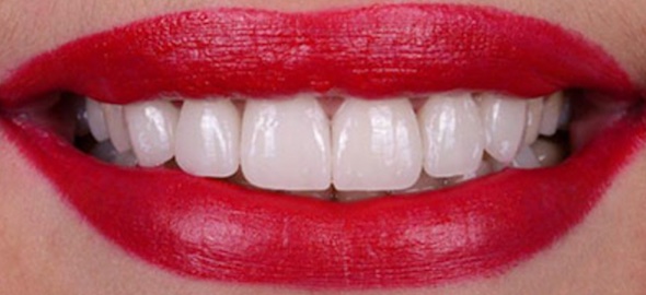 smile gallery image