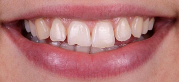 smile gallery image
