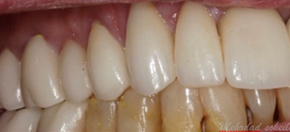 smile gallery image