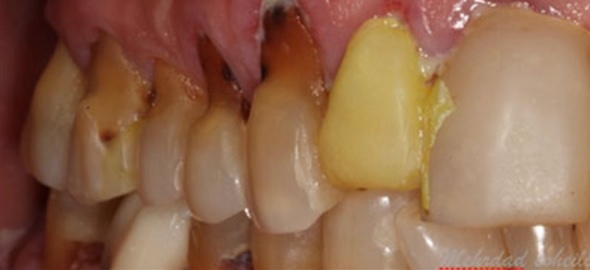 smile gallery image