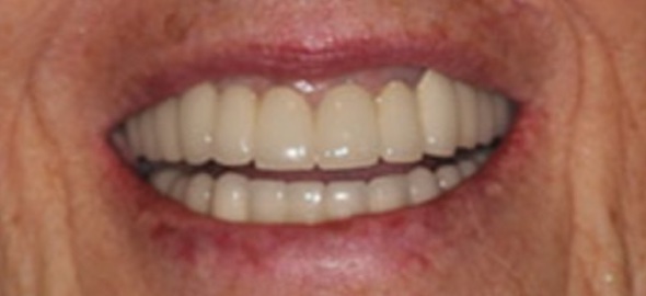 smile gallery image