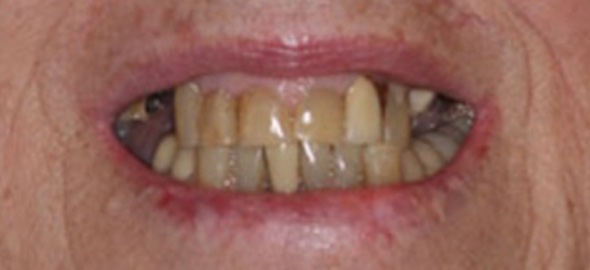 smile gallery image