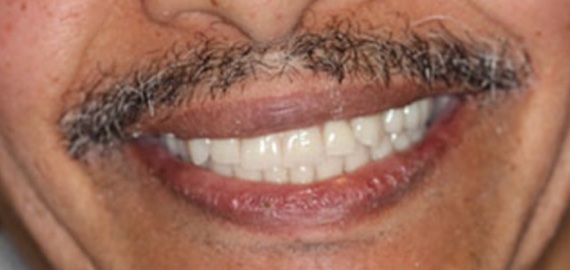 smile gallery image