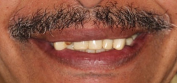 smile gallery image