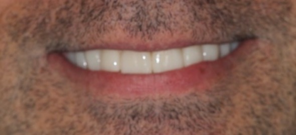 smile gallery image