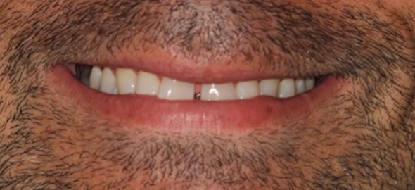 smile gallery image