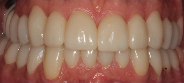 smile gallery image
