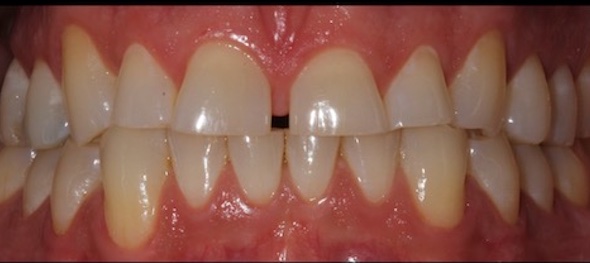 smile gallery image
