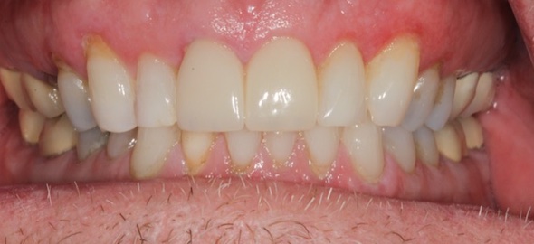smile gallery image