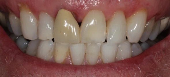 smile gallery image