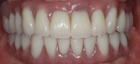 smile gallery image