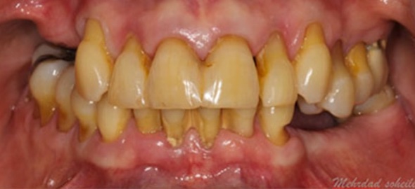 smile gallery image