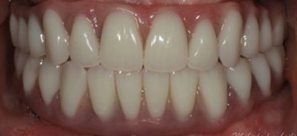 smile gallery image