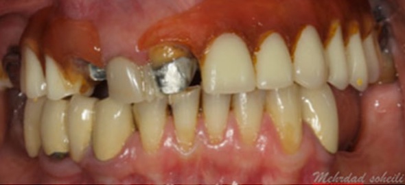 smile gallery image