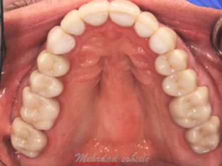 smile gallery image