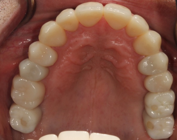 smile gallery image