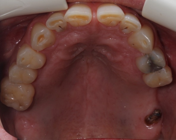 smile gallery image