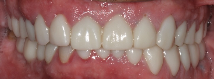 smile gallery image