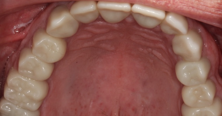 smile gallery image