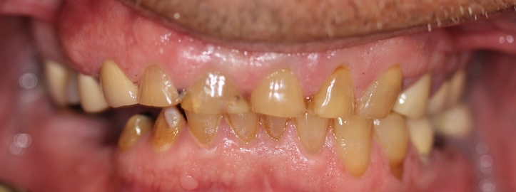 smile gallery image
