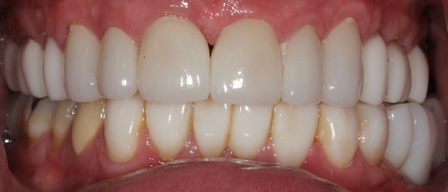 smile gallery image