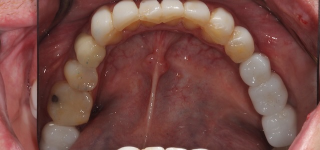 smile gallery image