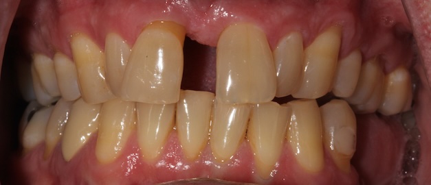 smile gallery image