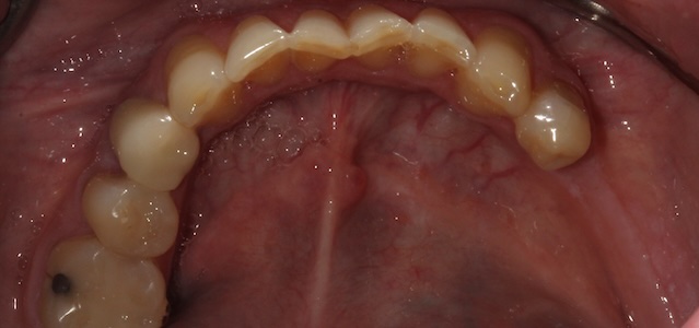 smile gallery image