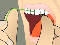 Flossing 3