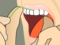 Flossing 4