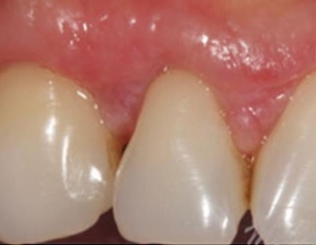 Case 10 after Case 10 after