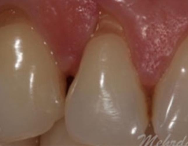 Case 10 before Case 10 before