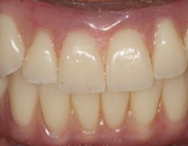 Case 12 after Case 12 after