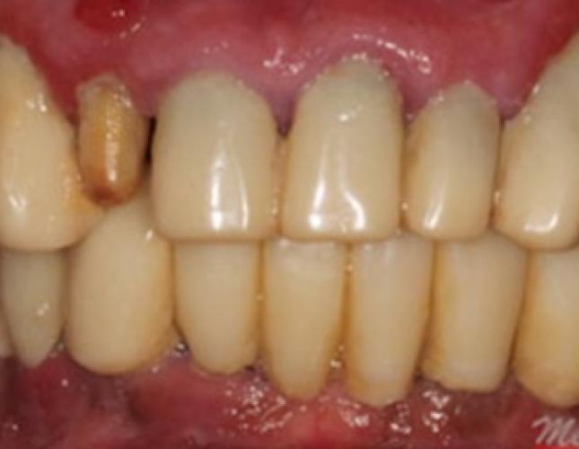 Case 12 before Case 12 before