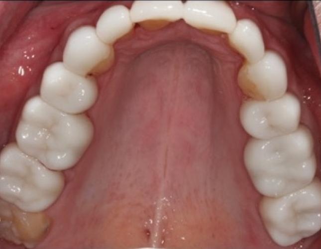 Case 16 after