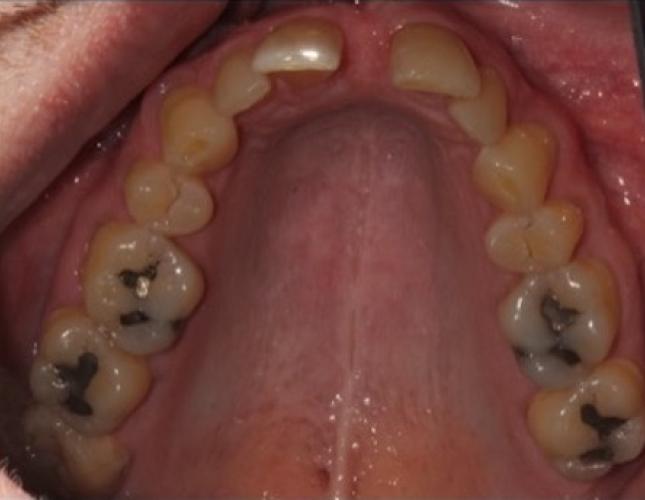 Case 16 before