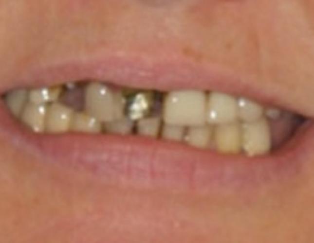 Case 19 before Case 19 before