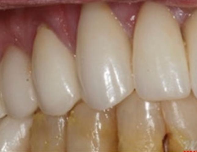 Case 20 after